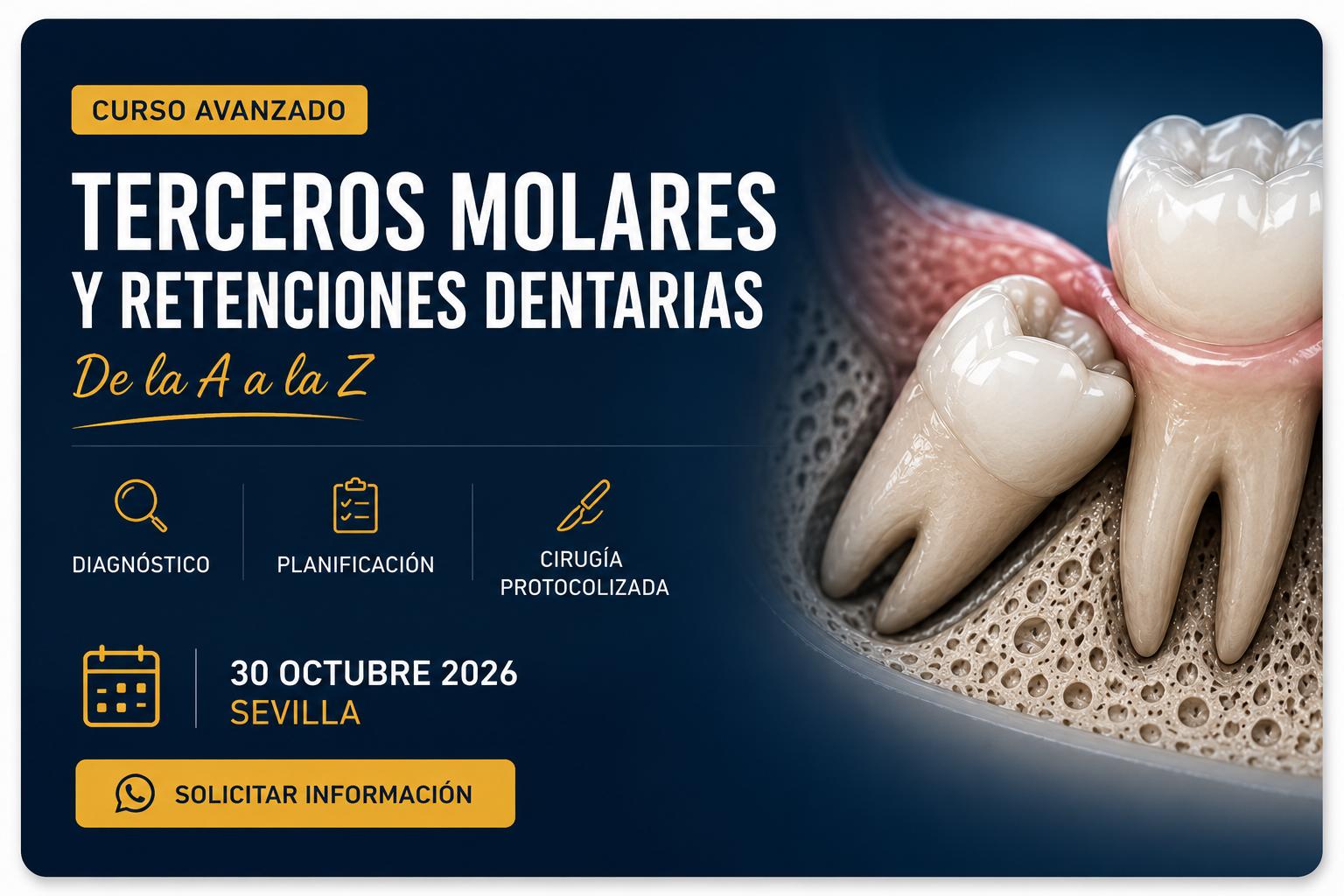 Curso intensivo de cirugía: Terceros molares y retenciones dentarias